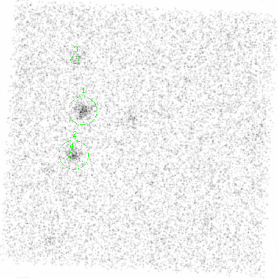 ccd5 smooth0cl image