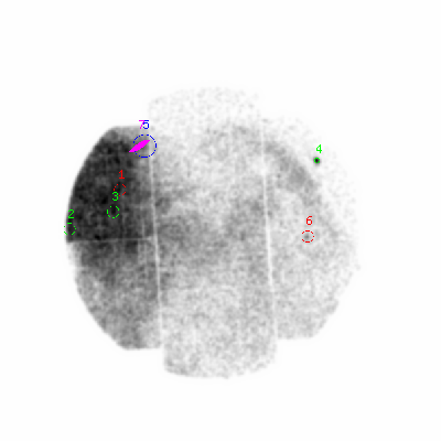 mos1 smooth0cl image