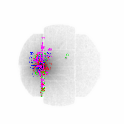 mos1 smooth0hcl image