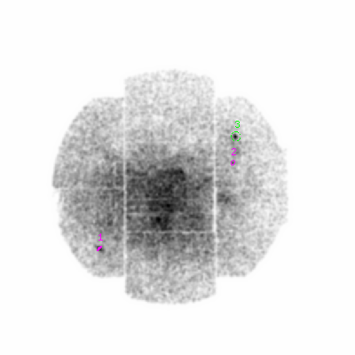 mos1 smooth0hcl image