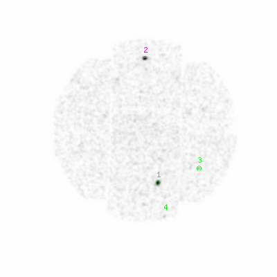 mos1 smooth0cl image