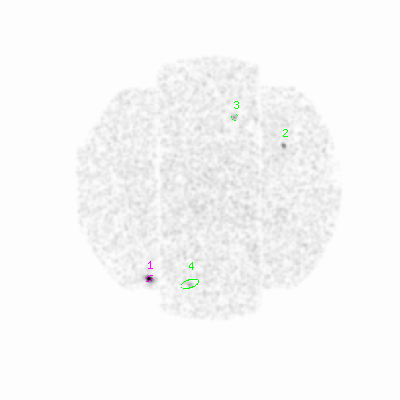 mos1 smooth0hcl image