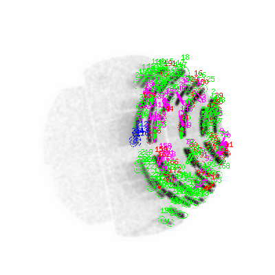 mos1 smooth0cl image