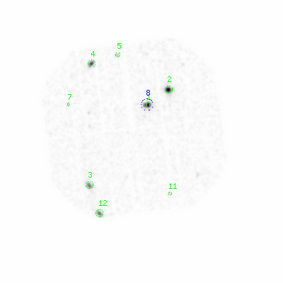 pn smooth0hcl image