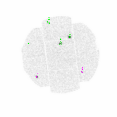 mos1 smooth0hcl image