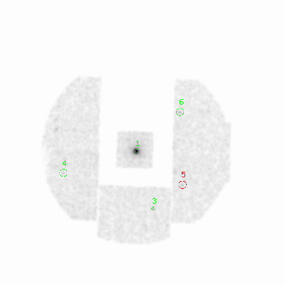 mos1 smooth0hcl image