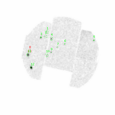 mos1 smooth0hcl image