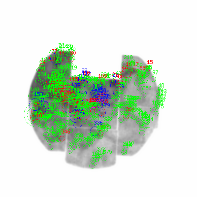 mos1 smooth0hcl image