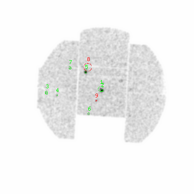 mos1 smooth0hcl image