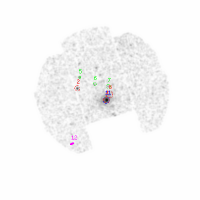 mos1 smooth0hcl image