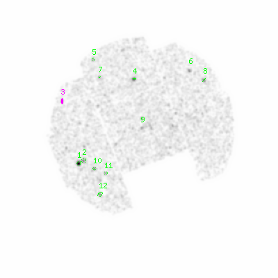 mos1 smooth0hcl image